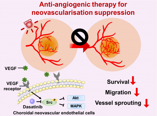 Anti-angiogenic therapy suppresses choroidal neovascularisation (CNV) by inhibiting vascular endothelial growth factor (VEGF)-related pathways. The study represents the first attempt at integrating a photoactivatable anti-angiogenic agent with a photosensitiser into a single nanoformulation for age-related macular degeneration treatment, which opens up new avenues for the development of minimally-invasive therapeutics for AMD and other neovascular ocular disorders.
 